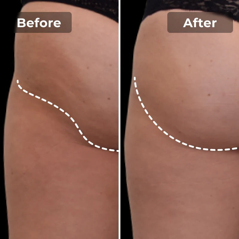 Snatchyfits™ EMS Toning Short