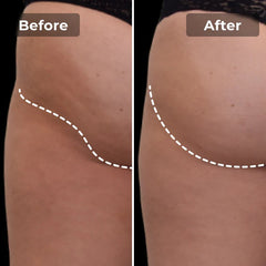 Snatchyfits™ EMS Toning Short