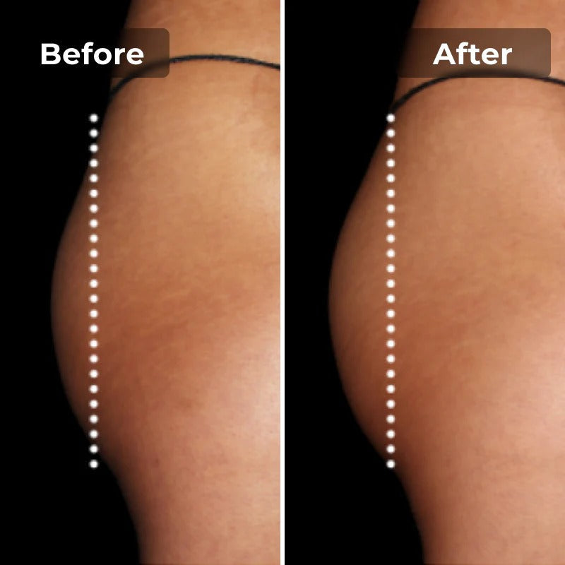 Snatchyfits™ EMS Toning Short