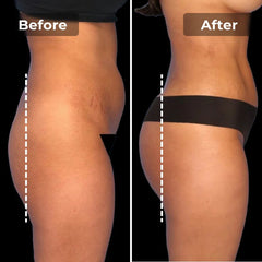 Snatchyfits™ EMS Toning Short